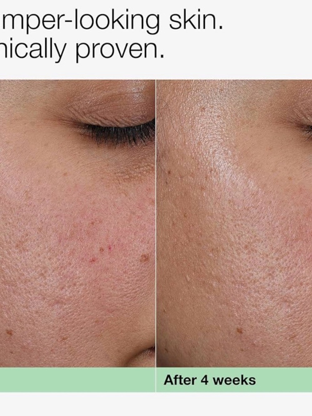 Clinique Smart Clinical Repair Collagen PDRN Cream Moisturizer Firmer Anti Aging - Picture 2 of 3